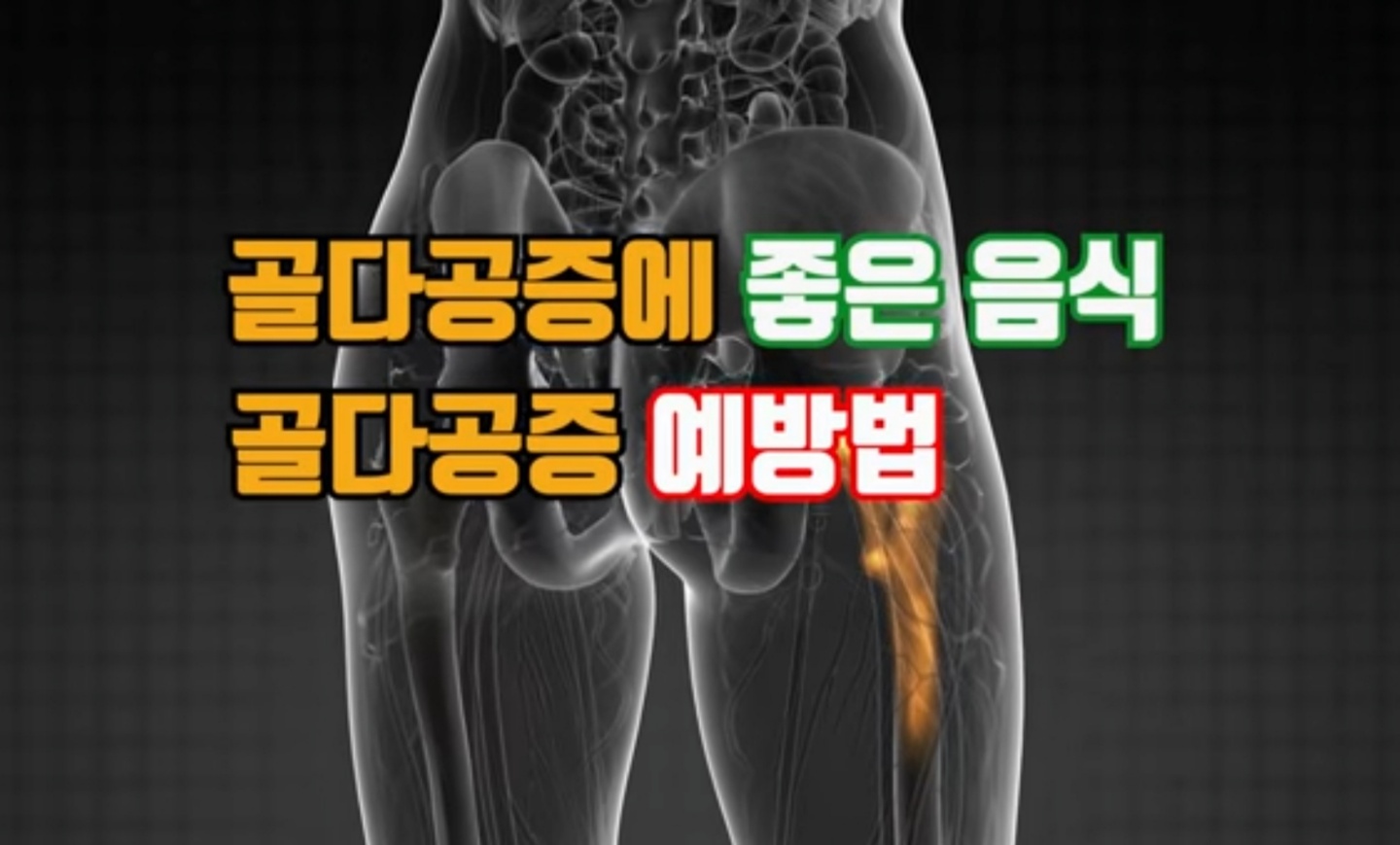 참조 