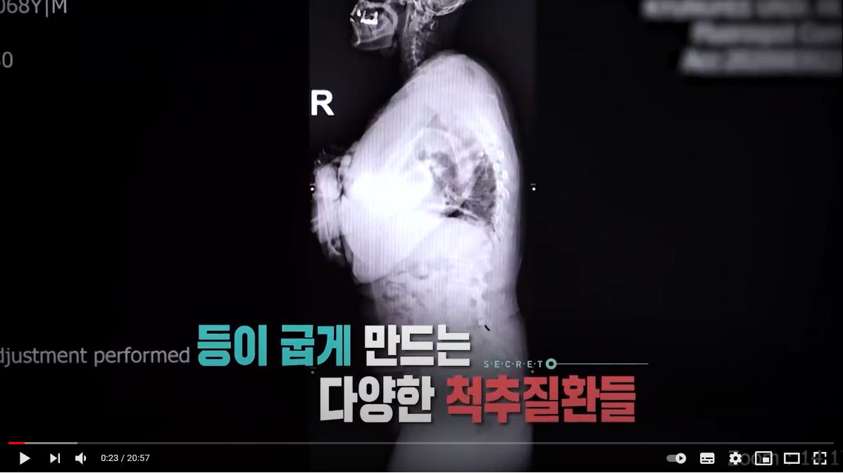 참조 